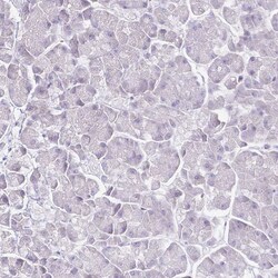 Invitrogen Cyclin B1 Polyclonal Antibody 100 &mu;L; Unconjugated:Antibodies,