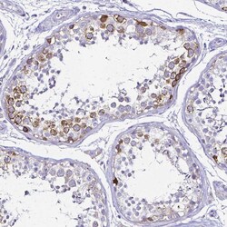 Invitrogen Cyclin B1 Polyclonal Antibody 100 &mu;L; Unconjugated:Antibodies,