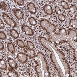Invitrogen GTF2B Polyclonal Antibody 100 &mu;L; Unconjugated:Antibodies,