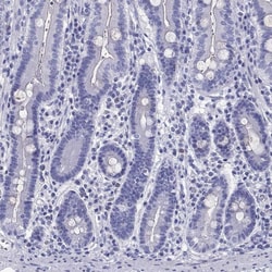 Invitrogen CYB5R2 Polyclonal Antibody 100 &mu;L; Unconjugated:Antibodies,