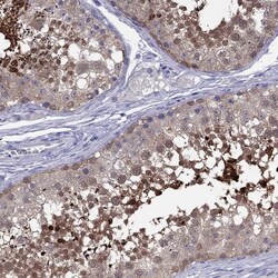 Invitrogen CYB5R2 Polyclonal Antibody 100 &mu;L; Unconjugated:Antibodies,