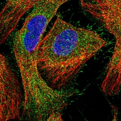 Invitrogen CCDC24 Polyclonal Antibody 100 &mu;L; Unconjugated:Antibodies,