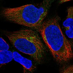 Invitrogen UBXN6 Polyclonal Antibody 100 &mu;L; Unconjugated:Antibodies,