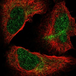 Invitrogen NUP85 Polyclonal Antibody 100 &mu;L; Unconjugated:Antibodies,
