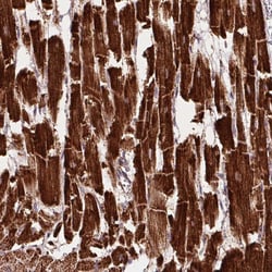 Invitrogen NDUFS2 Polyclonal Antibody 100 &mu;L; Unconjugated:Antibodies,