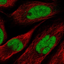 Invitrogen NOSIP Polyclonal Antibody 100 &mu;L; Unconjugated:Antibodies,