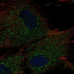 Invitrogen RC3H2 Polyclonal Antibody 100 &mu;L; Unconjugated:Antibodies,
