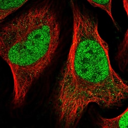 Invitrogen NAC1 Polyclonal Antibody 100 &mu;L; Unconjugated:Antibodies,