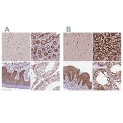Invitrogen NAC1 Polyclonal Antibody 100 &mu;L; Unconjugated:Antibodies,