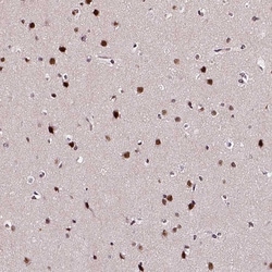 Invitrogen NAC1 Polyclonal Antibody 100 &mu;L; Unconjugated:Antibodies,