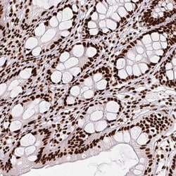 Invitrogen PAGE3 Polyclonal Antibody 100 &mu;L; Unconjugated:Antibodies,