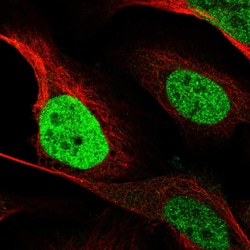 Invitrogen C/EBP beta Polyclonal Antibody 100 &mu;L; Unconjugated:Antibodies,