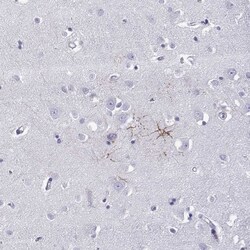 Invitrogen KCNF1 Polyclonal Antibody 100 &mu;L | Buy Online | Invitrogen&trade; | Fisher Scientific