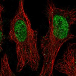 Invitrogen ZNF320 Polyclonal Antibody 100 &mu;L; Unconjugated:Antibodies,