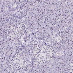 Invitrogen TCF3 Polyclonal Antibody 100 &mu;L; Unconjugated:Antibodies,