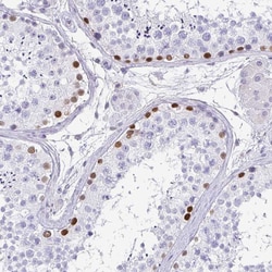 Invitrogen TCF3 Polyclonal Antibody 100 &mu;L; Unconjugated:Antibodies,