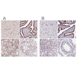 Invitrogen Lamin B2 Polyclonal Antibody 100 &mu;L; Unconjugated:Antibodies,