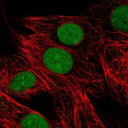 Invitrogen HMGB3 Polyclonal Antibody 100 &mu;L; Unconjugated:Antibodies,