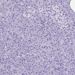 Invitrogen HMGB3 Polyclonal Antibody 100 &mu;L; Unconjugated:Antibodies,