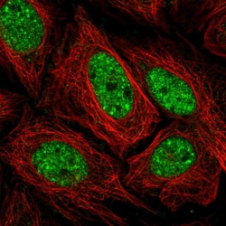 Invitrogen SERCA2 ATPase Polyclonal Antibody 100 &mu;L; Unconjugated:Antibodies,