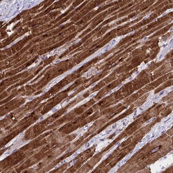 Invitrogen SERCA2 ATPase Polyclonal Antibody 100 &mu;L; Unconjugated:Antibodies,