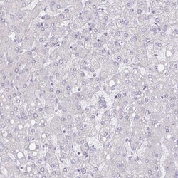 Invitrogen SERCA2 ATPase Polyclonal Antibody 100 &mu;L; Unconjugated:Antibodies,