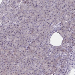 Invitrogen SERCA2 ATPase Polyclonal Antibody 100 &mu;L; Unconjugated:Antibodies,