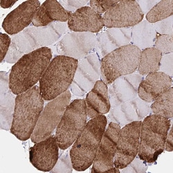 Invitrogen SERCA2 ATPase Polyclonal Antibody 100 &mu;L; Unconjugated:Antibodies,
