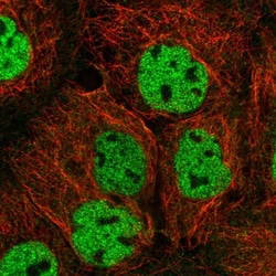 Invitrogen ORAOV1 Polyclonal Antibody 100 &mu;L; Unconjugated:Antibodies,