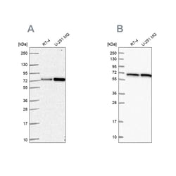Invitrogen DLAT Polyclonal Antibody 100 &mu;L; Unconjugated:Antibodies,