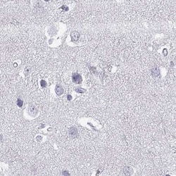Invitrogen Connexin 50 Polyclonal Antibody 100 &mu;L; Unconjugated:Antibodies,