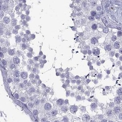 Invitrogen Connexin 50 Polyclonal Antibody 100 &mu;L; Unconjugated:Antibodies,
