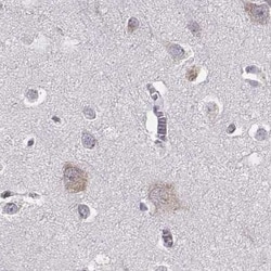 Invitrogen BFSP2 Polyclonal Antibody 100 &mu;L; Unconjugated:Antibodies,