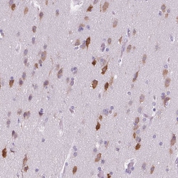 Invitrogen ELAVL2 Polyclonal Antibody 100 &mu;L; Unconjugated:Antibodies,