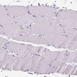 Invitrogen ELAVL2 Polyclonal Antibody 100 &mu;L; Unconjugated:Antibodies,