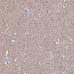 Invitrogen Acetyl-CoA Carboxylase Polyclonal Antibody 100 &mu;L; Unconjugated:Antibodies,