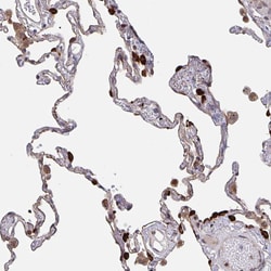 Invitrogen Acetyl-CoA Carboxylase Polyclonal Antibody 100 &mu;L; Unconjugated:Antibodies,