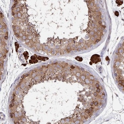 Invitrogen Acetyl-CoA Carboxylase Polyclonal Antibody 100 &mu;L; Unconjugated:Antibodies,