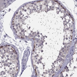 Invitrogen HSFX1 Polyclonal Antibody 100 &mu;L; Unconjugated:Antibodies,