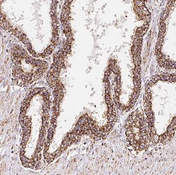 Invitrogen GBAS Polyclonal Antibody 100 &mu;L; Unconjugated:Antibodies,