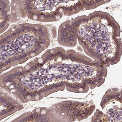 Invitrogen IRF6 Polyclonal Antibody 100 &mu;L | Buy Online | Invitrogen&trade; | Fisher Scientific