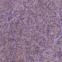 Invitrogen IRF6 Polyclonal Antibody 100 &mu;L | Buy Online | Invitrogen&trade; | Fisher Scientific