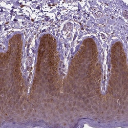 Invitrogen IRF6 Polyclonal Antibody 100 &mu;L | Buy Online | Invitrogen&trade; | Fisher Scientific