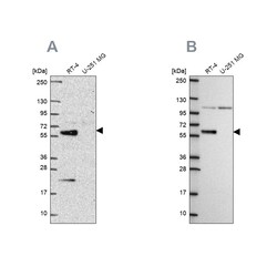 Invitrogen IRF6 Polyclonal Antibody 100 &mu;L | Buy Online | Invitrogen&trade; | Fisher Scientific