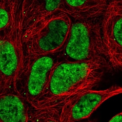 Invitrogen DDX17 Polyclonal Antibody 100 &mu;L; Unconjugated:Antibodies,