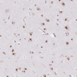 Invitrogen DDX17 Polyclonal Antibody 100 &mu;L; Unconjugated:Antibodies,