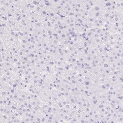 Invitrogen DDX17 Polyclonal Antibody 100 &mu;L; Unconjugated:Antibodies,