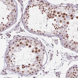 Invitrogen DDX17 Polyclonal Antibody 100 &mu;L; Unconjugated:Antibodies,