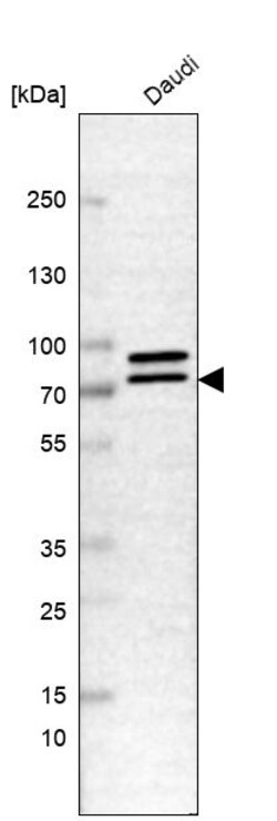 Invitrogen DDX17 Polyclonal Antibody 100 &mu;L | Buy Online | Invitrogen&trade; | Fisher Scientific