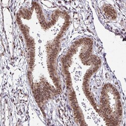 Invitrogen HSP40 Polyclonal Antibody 100 &mu;L | Buy Online | Invitrogen&trade; | Fisher Scientific